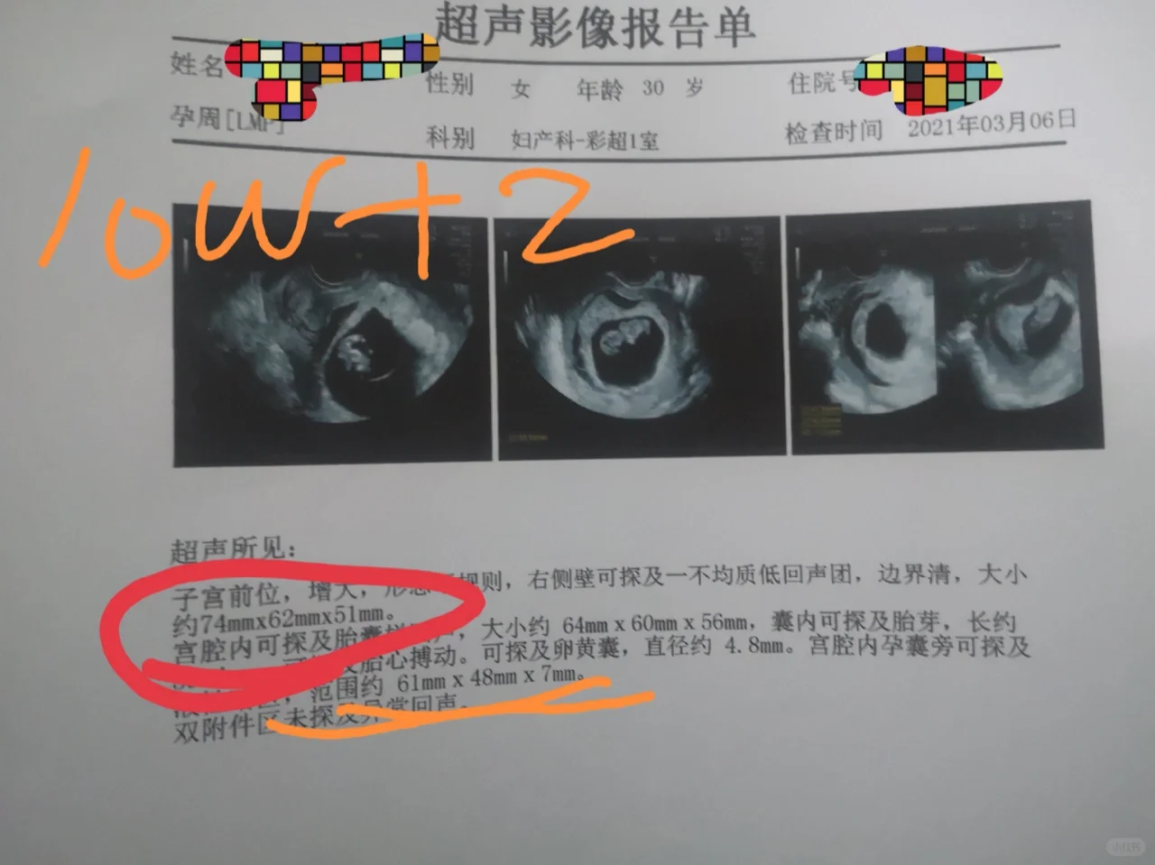 在深圳寻求生育希望：我的试管助孕得宝探索之旅